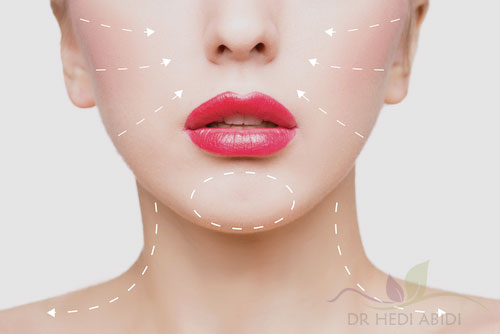 lifting visage tunisie