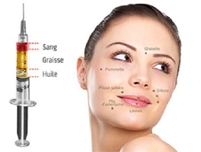 lipofilling visage tunisie