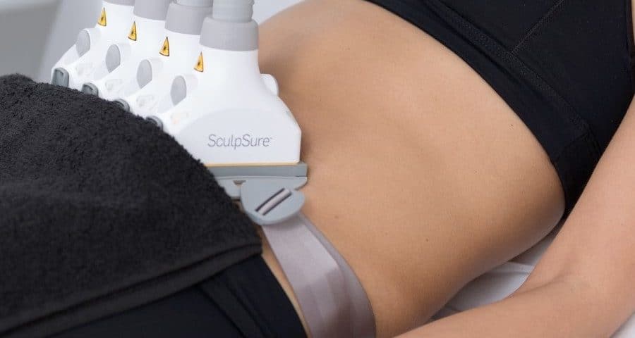 SculpSure ventre