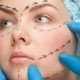 drainage lymphatique apres chirurgie esthetique