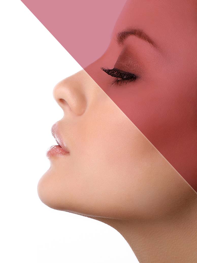 rhinoplastie médicale tunisie