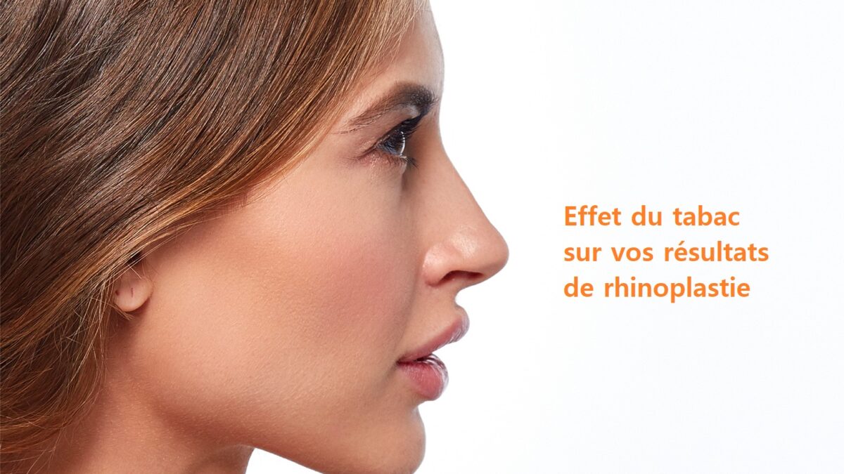 arret tabac rhinoplastie