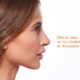 arret tabac rhinoplastie