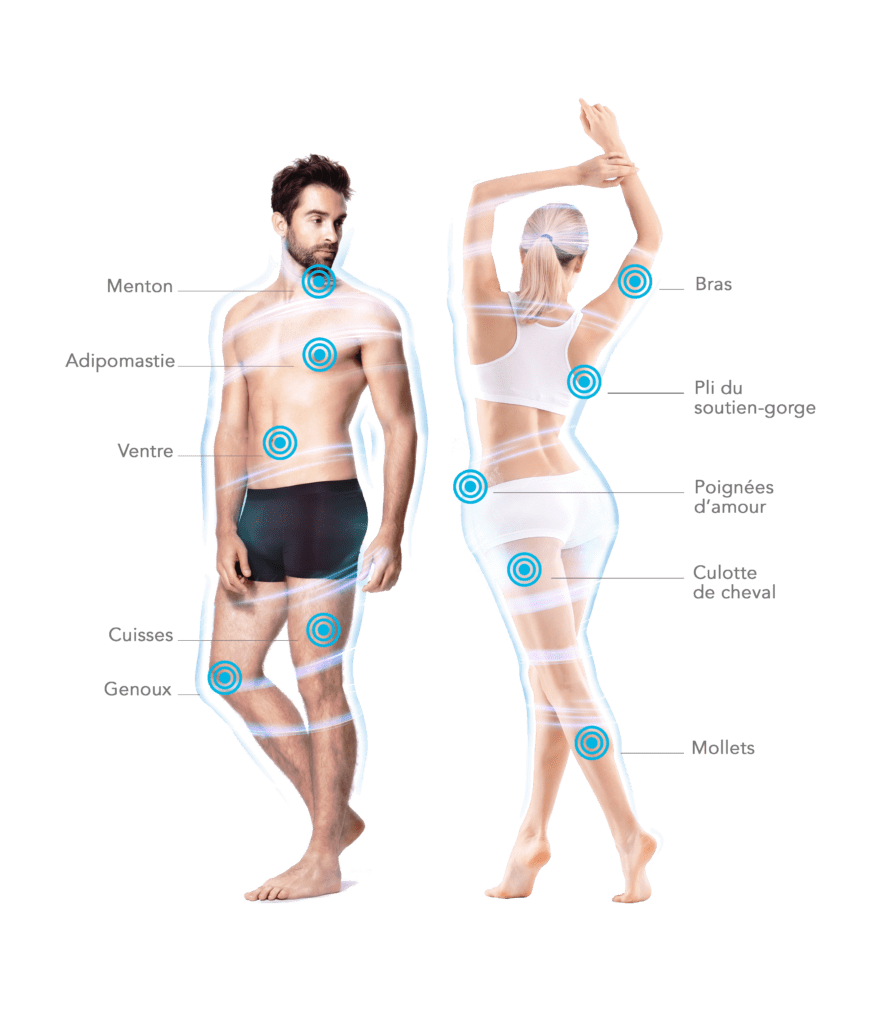 guide postoperatoire cryolipolyse