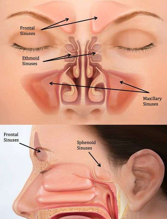 chirurgie fracture sinus