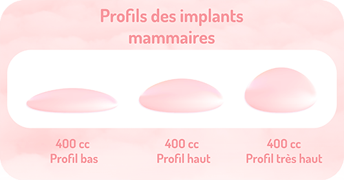 implant mammaire profil haut ou bas