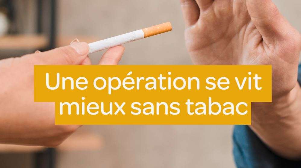 operation-et-tabac