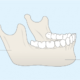 mandibule-hypercondylie-chirurgien-maxillo-facial