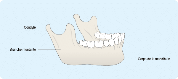 mandibule-hypercondylie-chirurgien-maxillo-facial