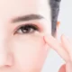 blepharoplastie asiatique