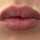 boule apres lip fillers