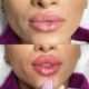 butterfly lips