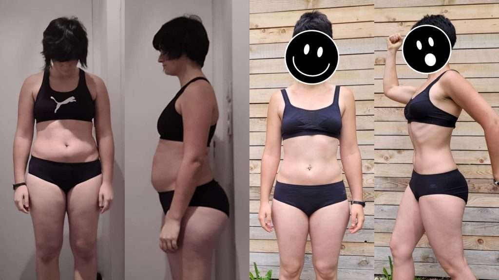 chirurgie esthetique ventre plat avant apres