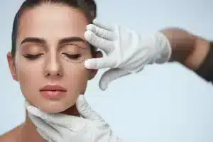 عملية تجميل الجفون في دبي