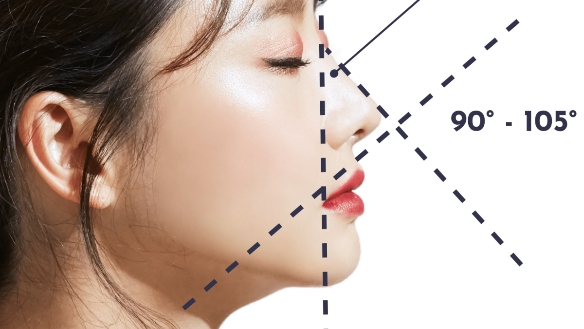 v line + barbie line rhinoplasty