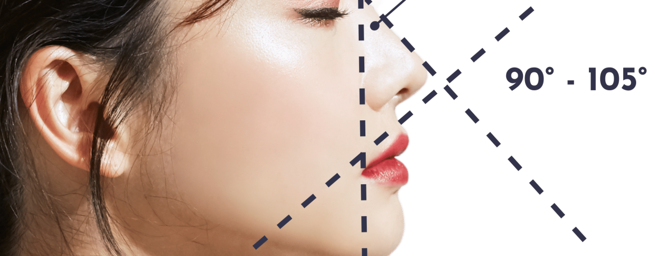 v line + barbie line rhinoplasty