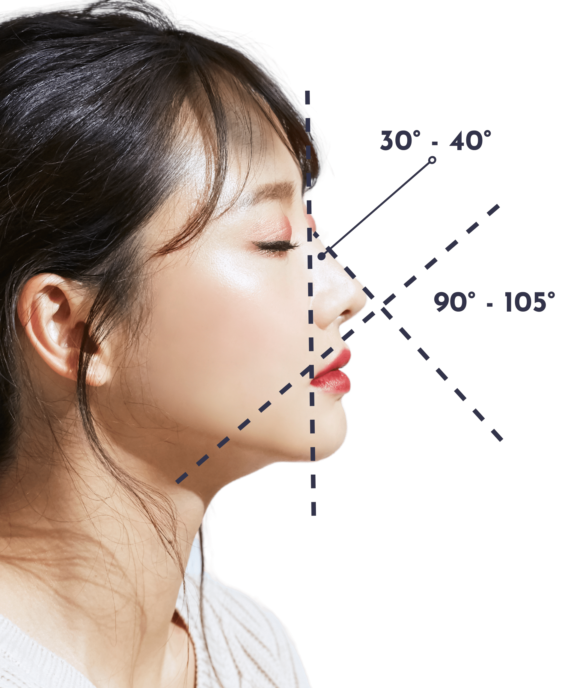 v line + barbie line rhinoplasty