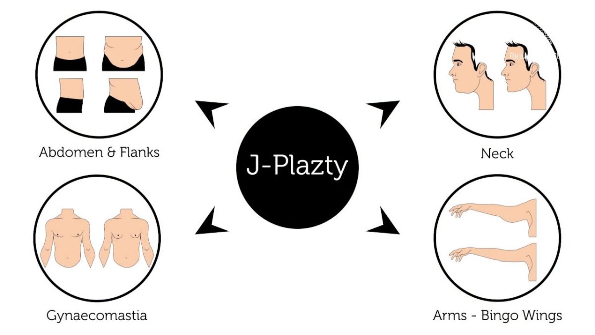 J- Plazty abs