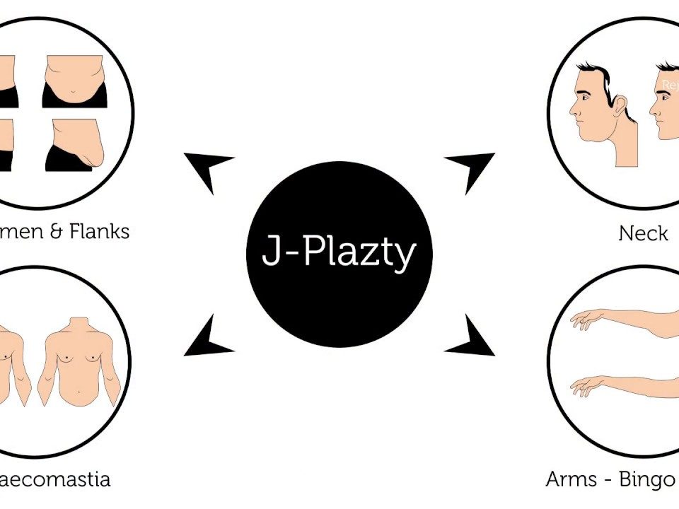 J- Plazty abs