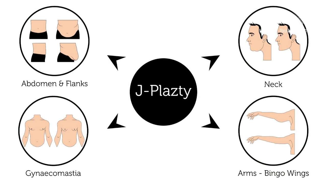 J- Plazty abs