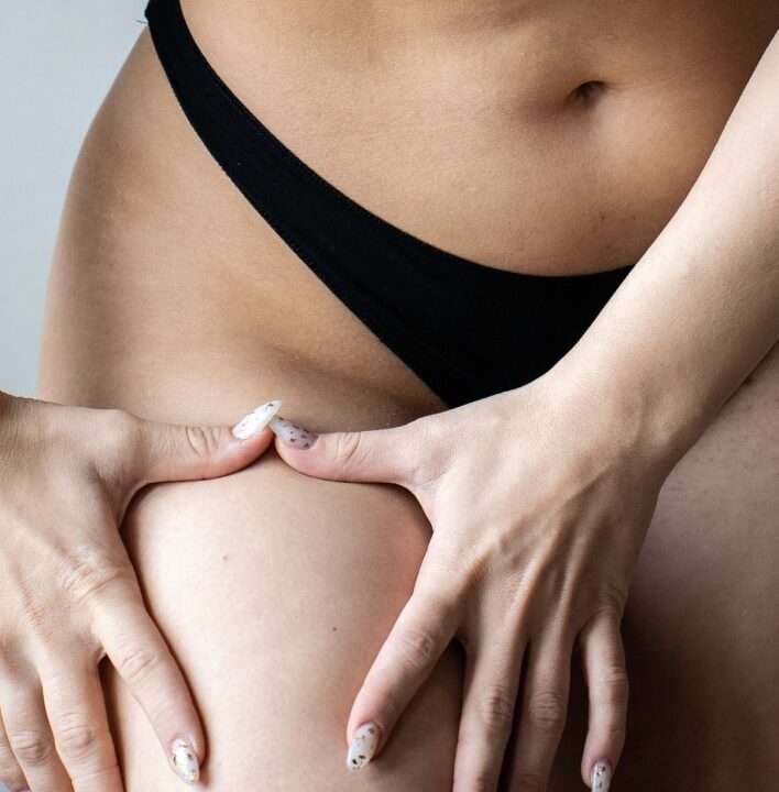 bodylift apres chirurgie lipoedeme par vaser