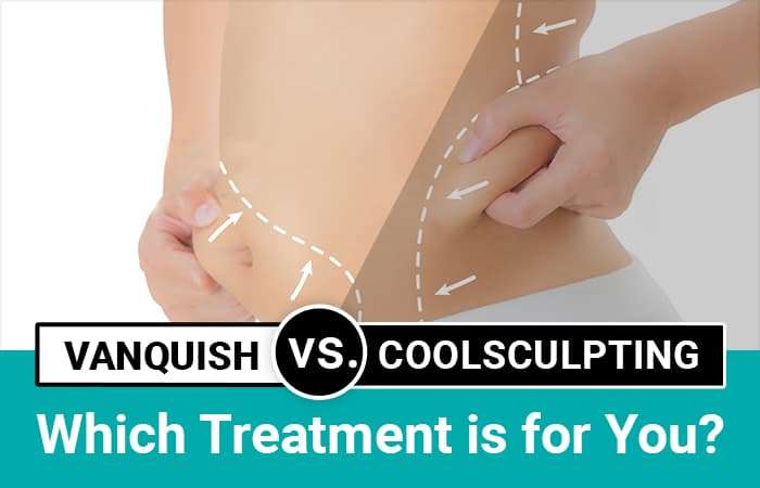 VanquishME, CoolSculpting, SculpSure