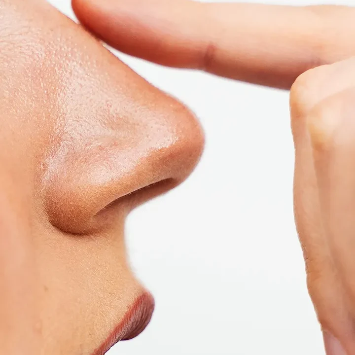 augmentation rhinoplasty for larger nose