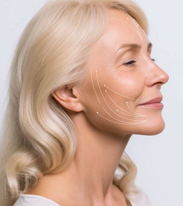 hybrid facelift