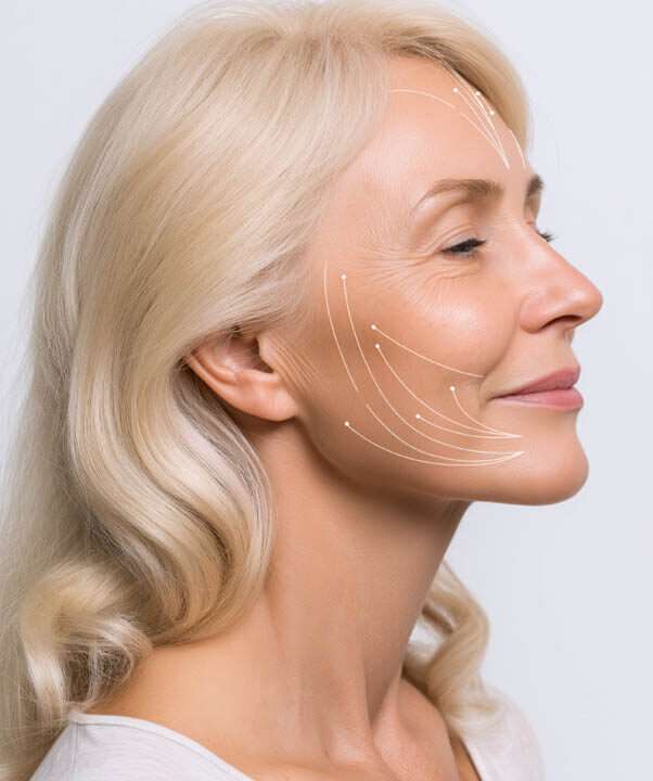 hybrid facelift